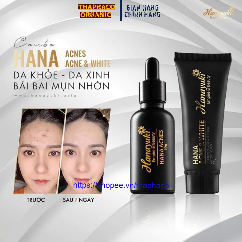 Hana Acne White Tuýp 25gr - Kem Mụn Trắng Da Hanayuki Date 2023