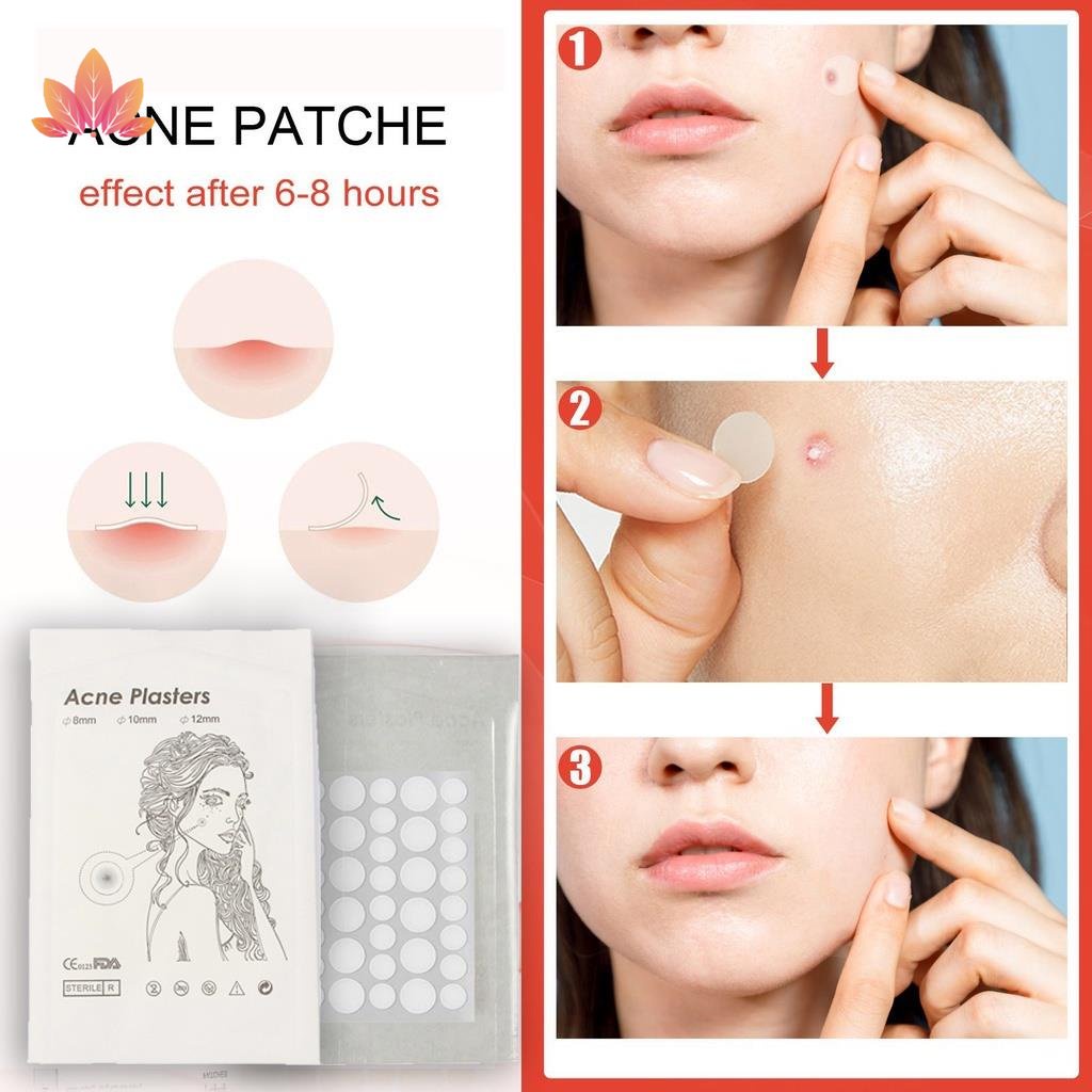 Bộ 36 Miếng Dán Loại Bỏ Mụn Đầu Đen Chăm Sóc Da Mặt JP5