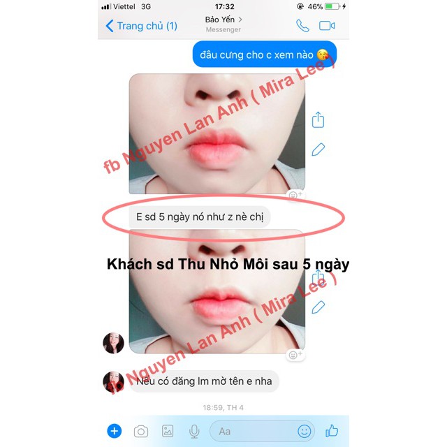 Tinh Chất Thu Nhỏ Môi Miracle