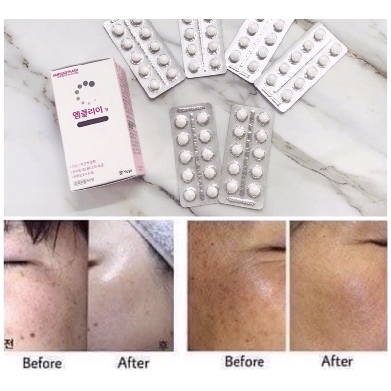 Viên Uống Mờ Nám M Clear