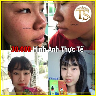 (っ◔◡◔)っ ♥ TINH CHẤT ♥ HẾT MỤN NÁM BHD