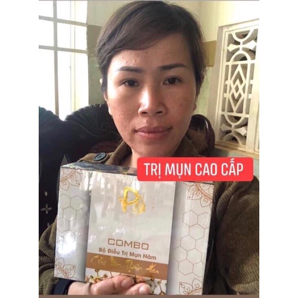 COMBO CAO CẤP LOẠI  BỎ MỤN _ NÁM  . CỬU MỘC THIÊN HOA | BigBuy360 - bigbuy360.vn