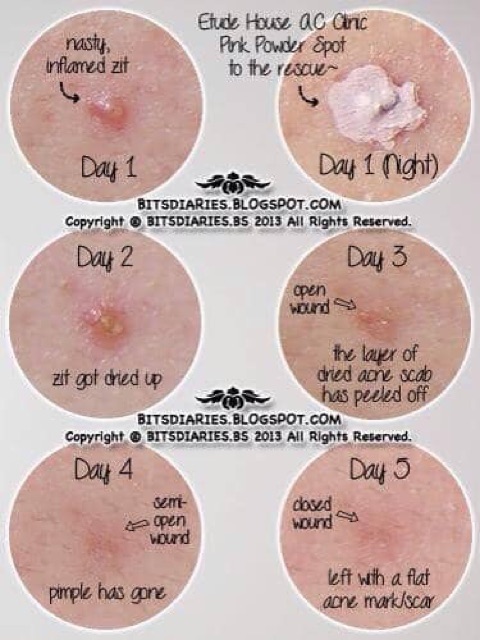 [Mẫu mới] Chấm mụn AC CLEAN UP PINK POWDER SPOT | BigBuy360 - bigbuy360.vn