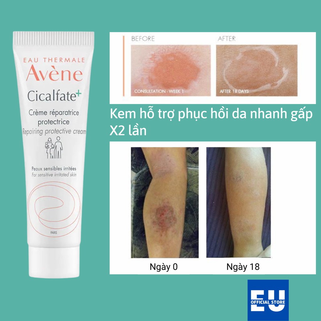 Kem tái tạo hồi phục da Avene Cicalfate Repair Cream