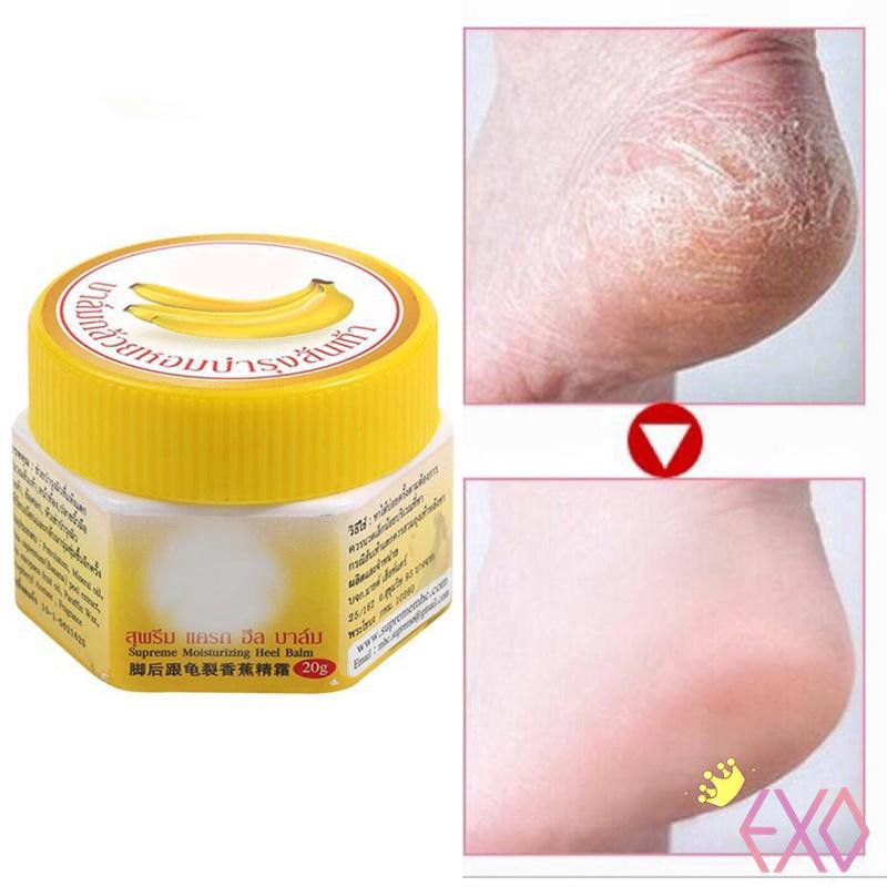 Kem tẩy tế bào chết trị nứt gót chân làm mềm da chân hiệu quả