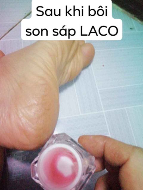 [ Rẻ vô địch ] SON SÁP LACO DƯỠNG HỒNG VÀ CHỐNG THÂM MÔI | BigBuy360 - bigbuy360.vn