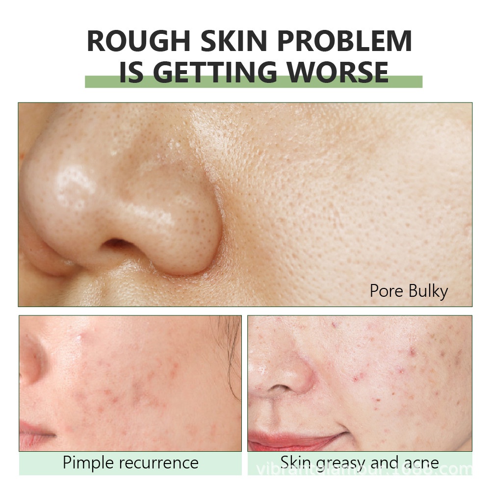 Serum se khít lỗ chân lông COCUTE chiết xuất thảo mộc dưỡng ẩm kiềm dầu làm săn chắc làn da 15ml