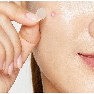 [Y172] Miếng dán mụn Acne Pimple Master Patch Cosrx - Yunaa Cosmetics
