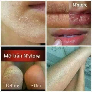 Mỡ trăn Nstore