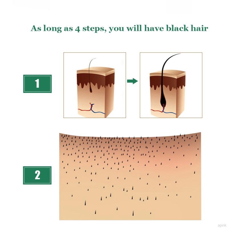 Tinh dầu chiết xuất gừng nuôi dưỡng giúp mọc tóc cho nam nữ