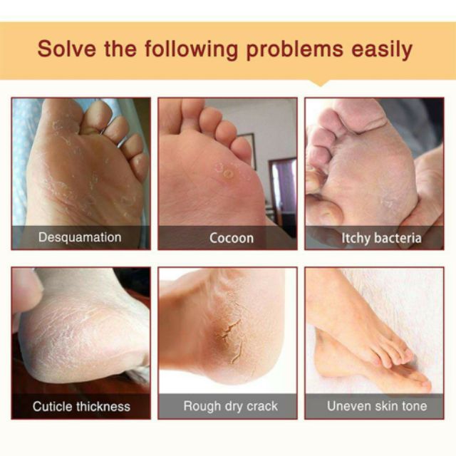 🌸MẶT NẠ Ủ CHÂN LỘT DA CHẾT ALIVER FOOT EXFOLIATING FOOT MASK | BigBuy360 - bigbuy360.vn