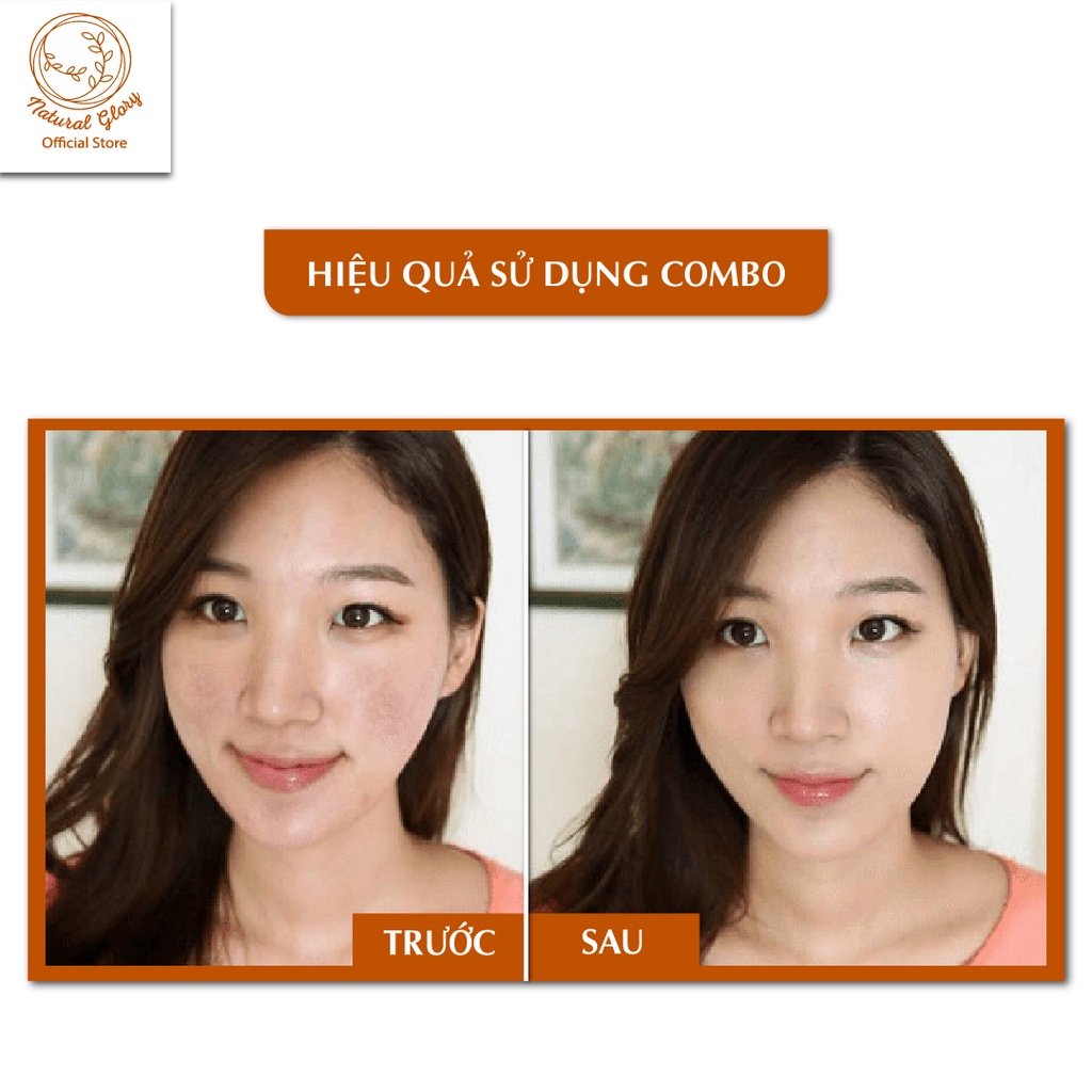 Combo Toner loại bỏ nám Dongsung Rannce 130ml và Kem loại bỏ nám Dongsung Rannce Cream 70g