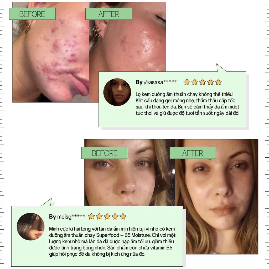 Kem Dưỡng Ẩm Thuần Chay Cho Da Dầu Nhạy Cảm Vegick Superfood + B5 Moisture Cream 50ml