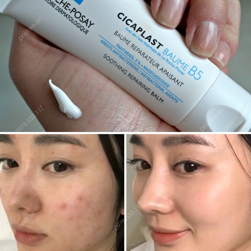 Kem B5 La Roche Posay Cicaplast Baume B5 100ml