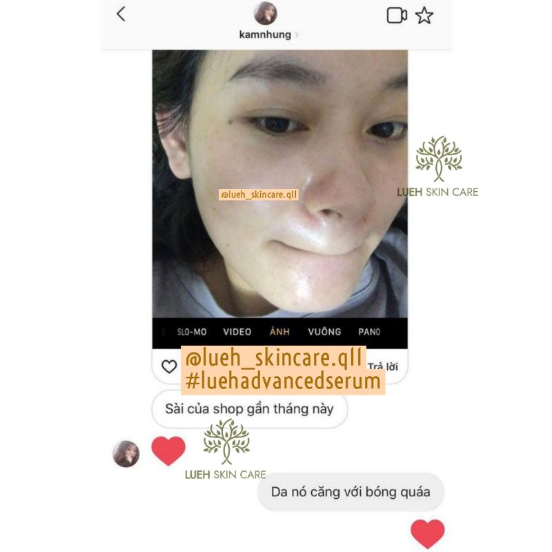 Advanced Serum LUEH - Serum Lô Hội dưỡng ẩm, căng bóng, trắng hồng, thấm nhanh_Whitening Repair Night Serum
