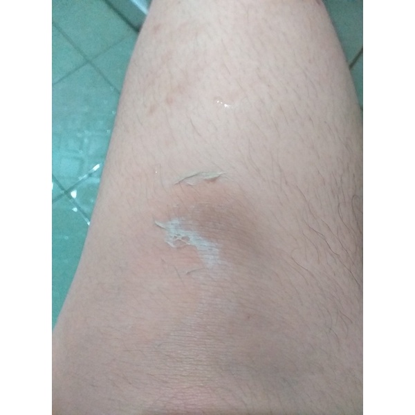 Biowhite Body Peeling Rucos - Tinh Chất Tái Tạo Da