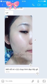 Mặt Nạ Thải Độc DJ Carbon Therapy CO2