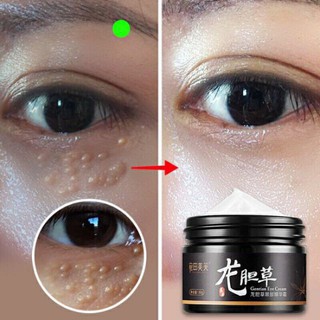 Kem mụn thịt quanh mắt ( cam kết chuẩn 100%) (shop_uytin88)