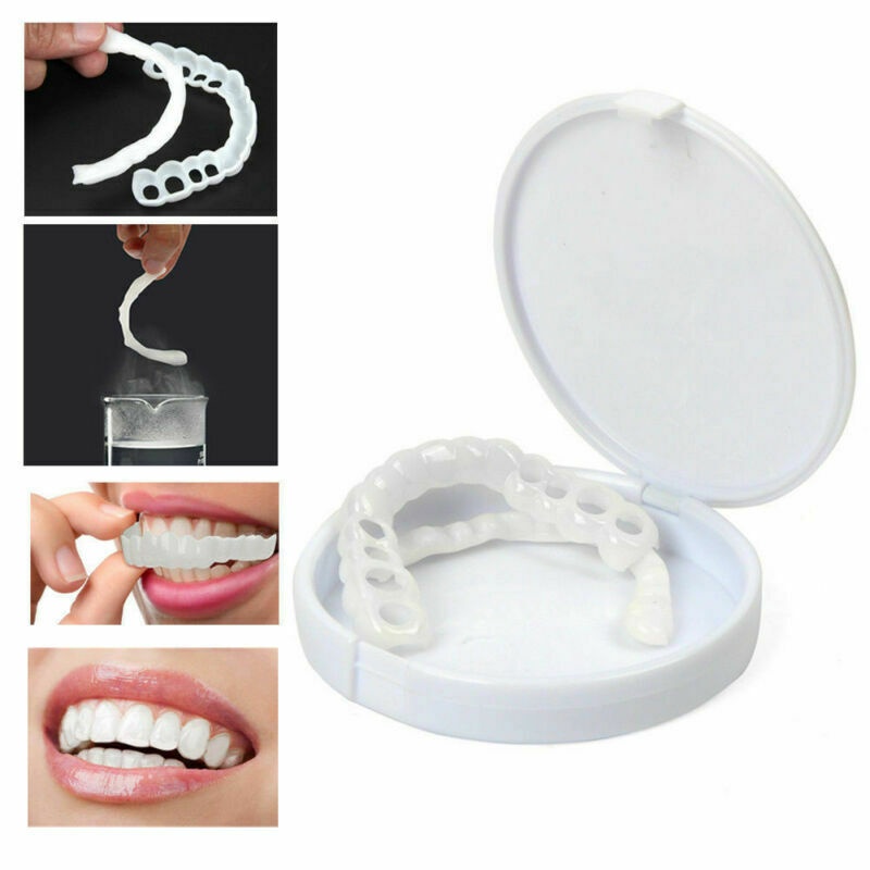 Nha khoa chụp trên nụ cười hoàn hảo tức thì veneers răng thoải mái trên & dưới