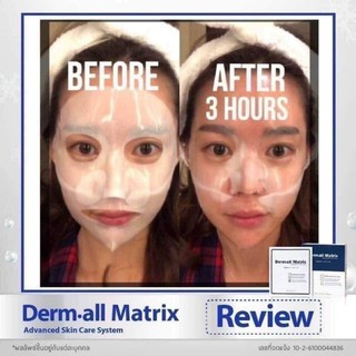 Mặt nạ thạch Derm All Matrix - đắp qua đêm