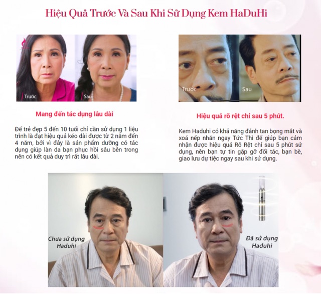 Kem Xoá Nhăn - Tan Bọng Mắt - Thâm Quầng Mắt Haduhi 15Gam [hàng nhập khẩu Hàn Quốc] | BigBuy360 - bigbuy360.vn