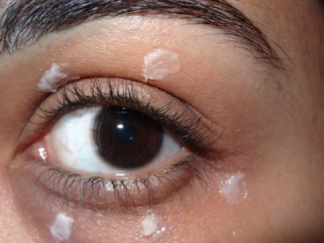 [ MUA 1 TẶNG 1] Kem dưỡng mắt Clinique All About Eye 15ml