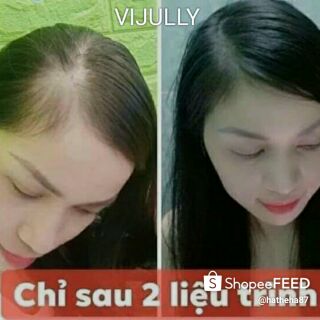 [Tinh Dầu Bưởi] TINH DẦU BƯỞI _GIẢM RỤNG TÓC GIÚP MỌC TÓC