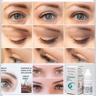 [tặng quà] serum dưỡng và mọc mi careprost ấn độ chính hãng