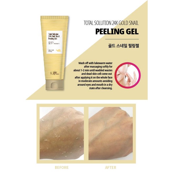 [DATE 07/22]Gel tẩy da chết chống lão hóa, mờ thâm, nám, sạm chiết xuất Ốc sên &amp; Vàng 24k Prettyskin Total Solution 150g