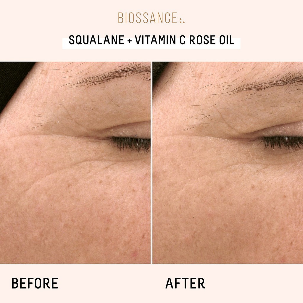 Dầu Dưỡng hữu cơ Biossance Squalane + Vitamin C Rose Oil