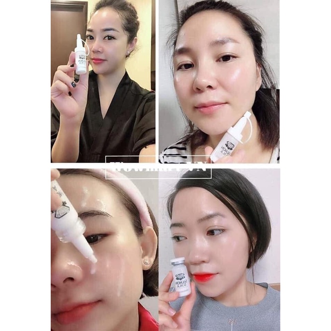 Tế Bào Gốc Cá Hồi SUPER SKIN SALMON DNA Chính Hãng - HỘP 10 lọ HSD 2025