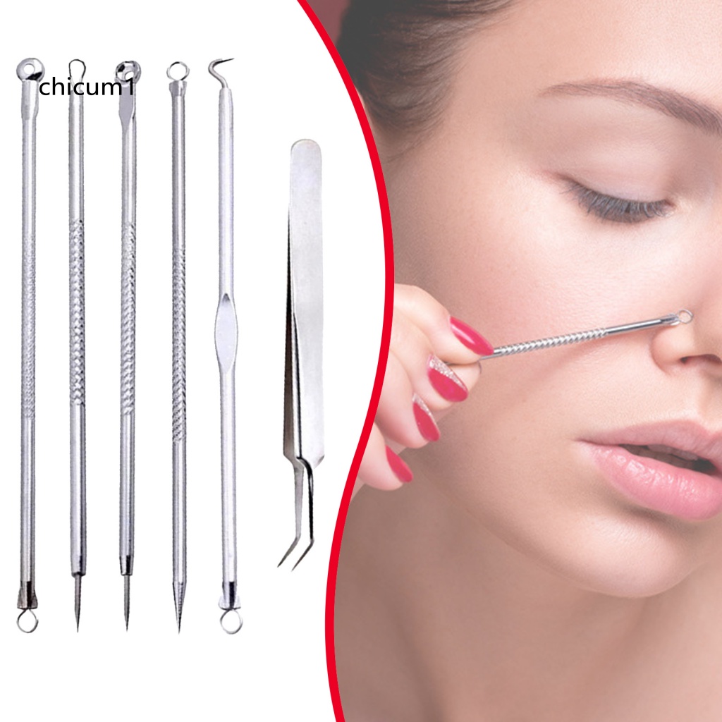 Set 6 Dụng Cụ Nặn Mụn An Toàn Tiện Dụng