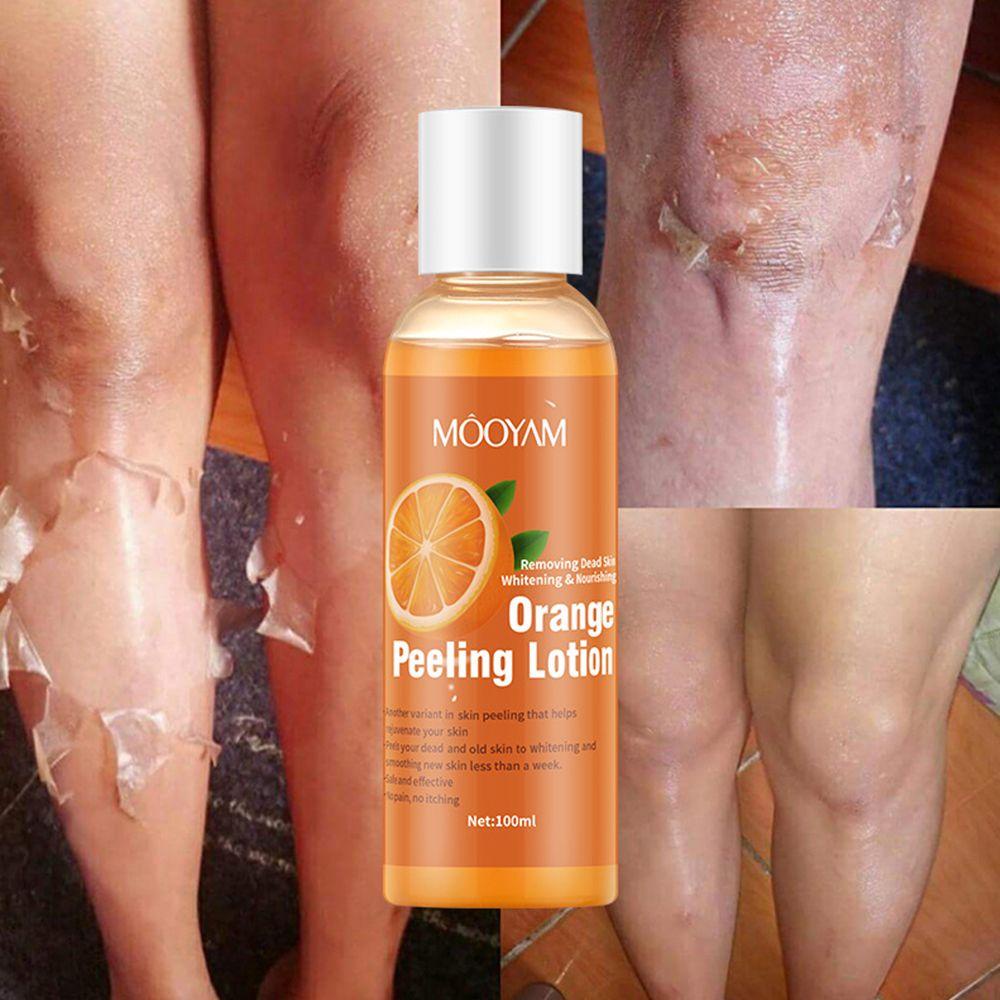 Gel Tẩy Tế Bào Chết Làm Trắng Da Toàn Thân