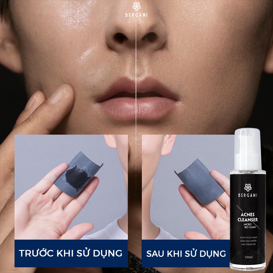 Combo Quà Tặng Nam Hoàn Hảo, Sữa Rửa Mặt Nam Bùn Khoáng Bergami 100ml và Dung Dịch Vệ Sinh Nam 130ml