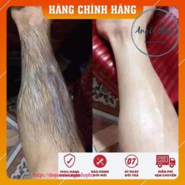 [FreeShip Hàng Cao Cấp] - Combo Kem Tẩy Lông Huyền Phi Triệt Sạch Bất Chấp các loại lông phù hợp với mọi loại da