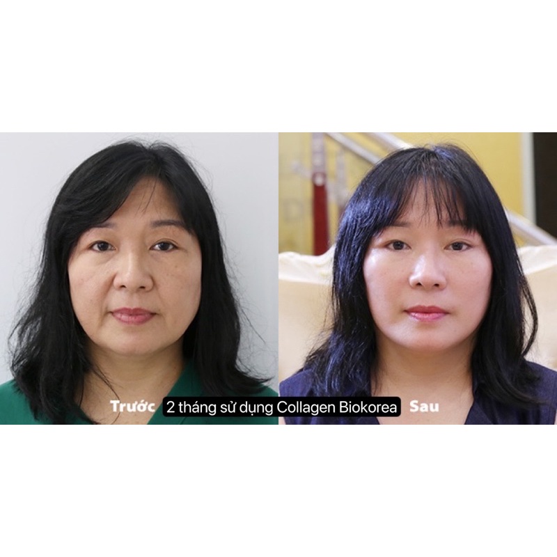 COLLAGEN BIOKOREA nước uống sáng đẹp da, giảm nám tàn nhang, chống lão hoá nâng tone da
