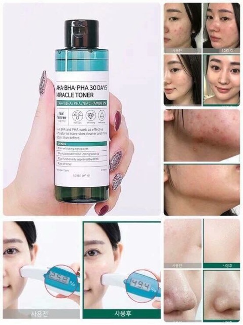 Nước hoa hồng da mụn AHA-BHA-PHA 30 Days Miracle Toner Some By Mi | BigBuy360 - bigbuy360.vn