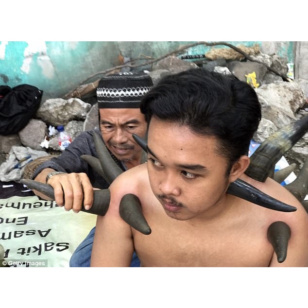 Dụng cụ giác hơi bằng sừng trâu tự nhiên