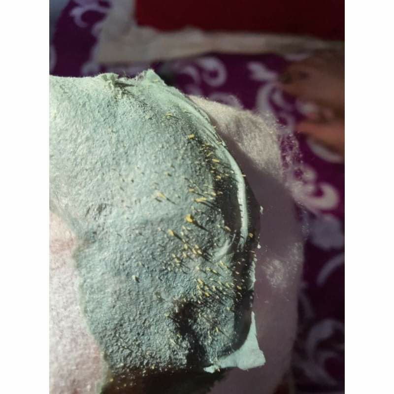 [ Hàng Hót ] Gell Lột Mụn DR.ACNE cty Hải Âu | Thế Giới Skin Care