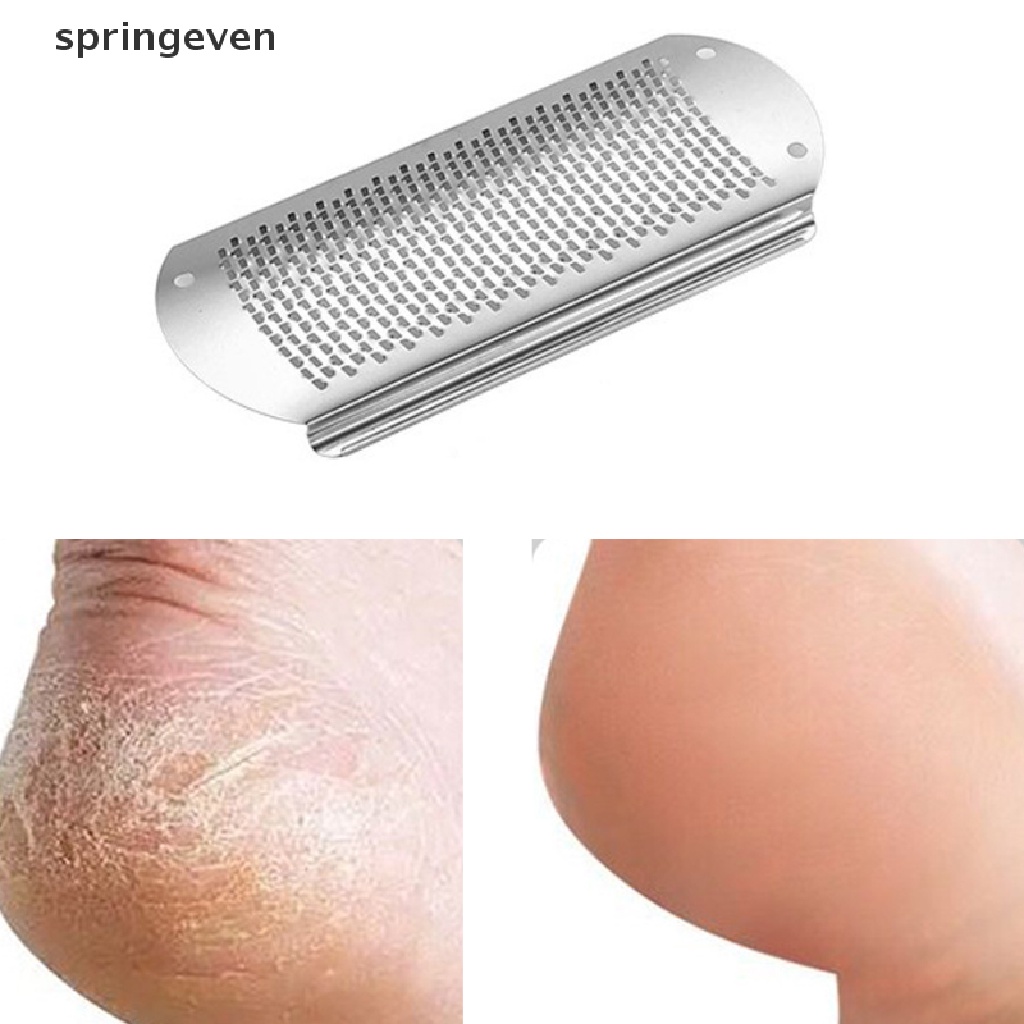 Dụng Cụ Chà Gót Chân Tẩy Tế Bào Chết Bằng Thép Không Gỉ