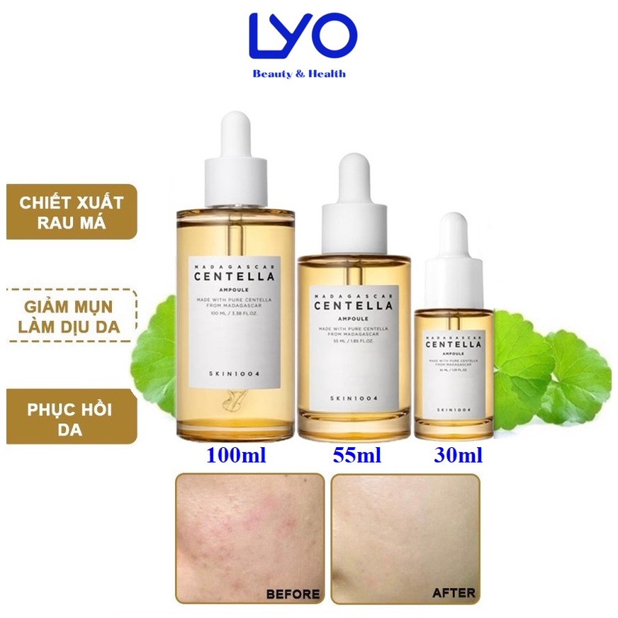 Tinh Chất Rau Má Da Skin1004 Madagascar Centella Ampoule.