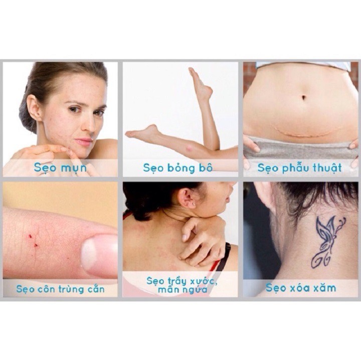 ✅[CHÍNH HÃNG] Kem trị sẹo lồi Rejuvasil scar gel 10g - Phân phối chính thức | BigBuy360 - bigbuy360.vn