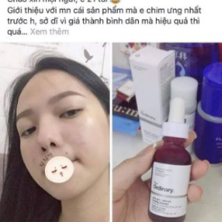 SERUM THE ORDINARY 
 – AHA 30% + BHA 2% PEELING SOLUTION