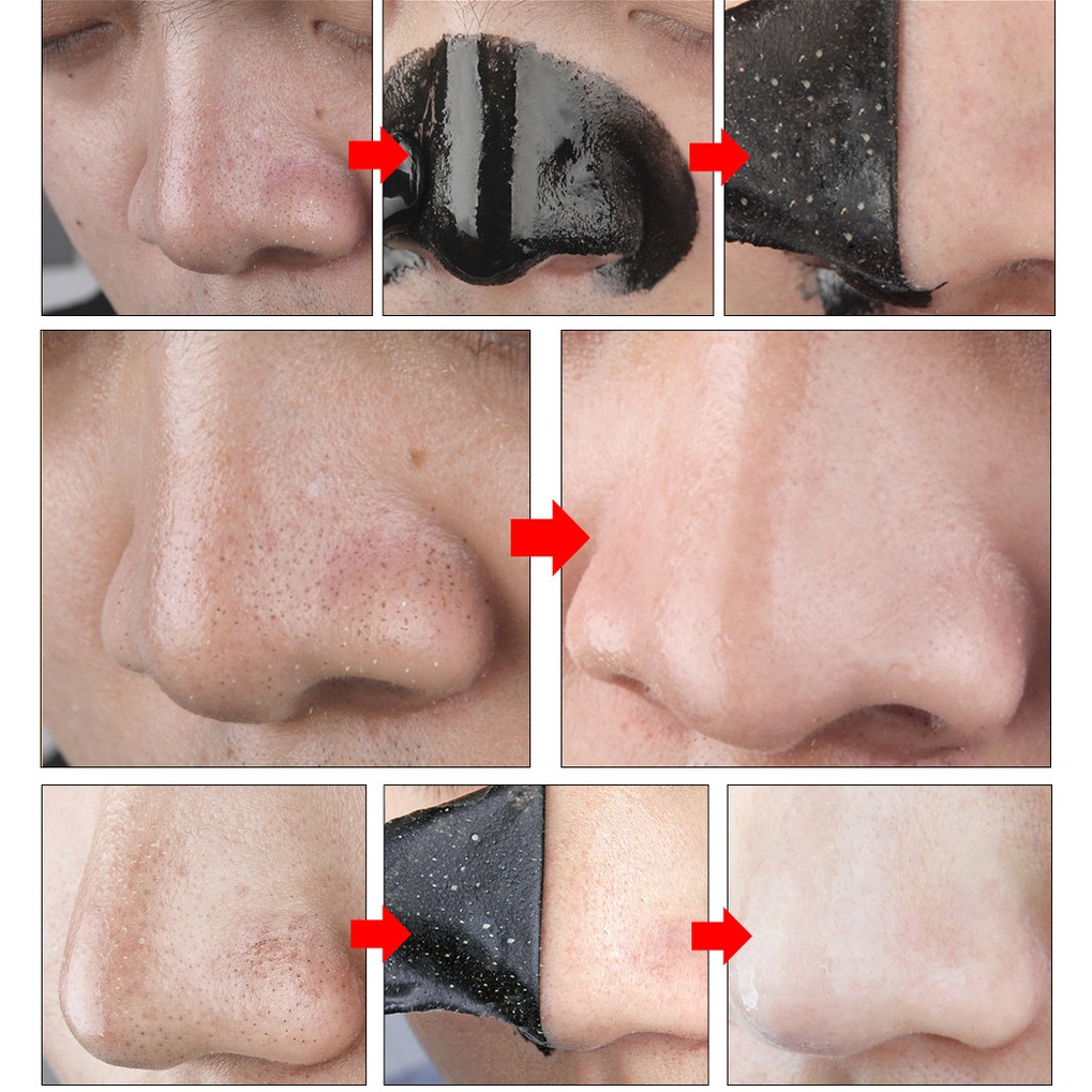 Gói Mặt Nạ Lột Mụn Đầu Đen LANBENA Blackhead Remover Mask | BigBuy360 - bigbuy360.vn