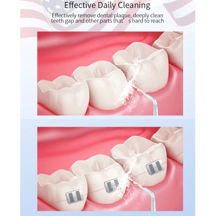 Máy Tăm Nước Không Dây Cao Cấp Oral Irrigator FL-V8 - Dụng Cụ Vệ Sinh Chăm Sóc Răng Miệng Chuyên Nghiệp - Bảo Hành 1 Năm