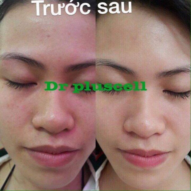 Mặt nạ tái tạo da Dr Pluscell Essence Mask