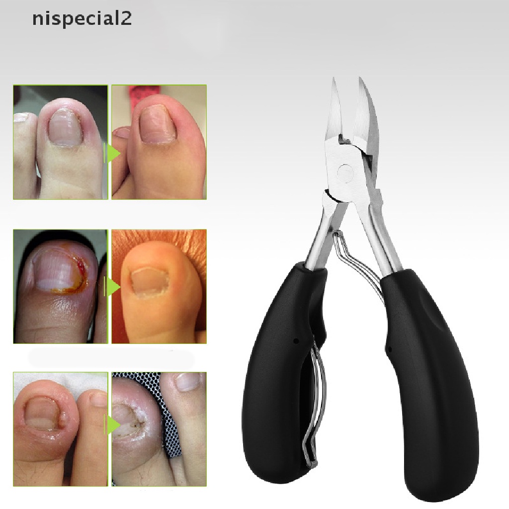[nispecial2] Toe Nail Clippers Remove Dead Skin Nail Correction Nippers Ingrown Toenail [new]