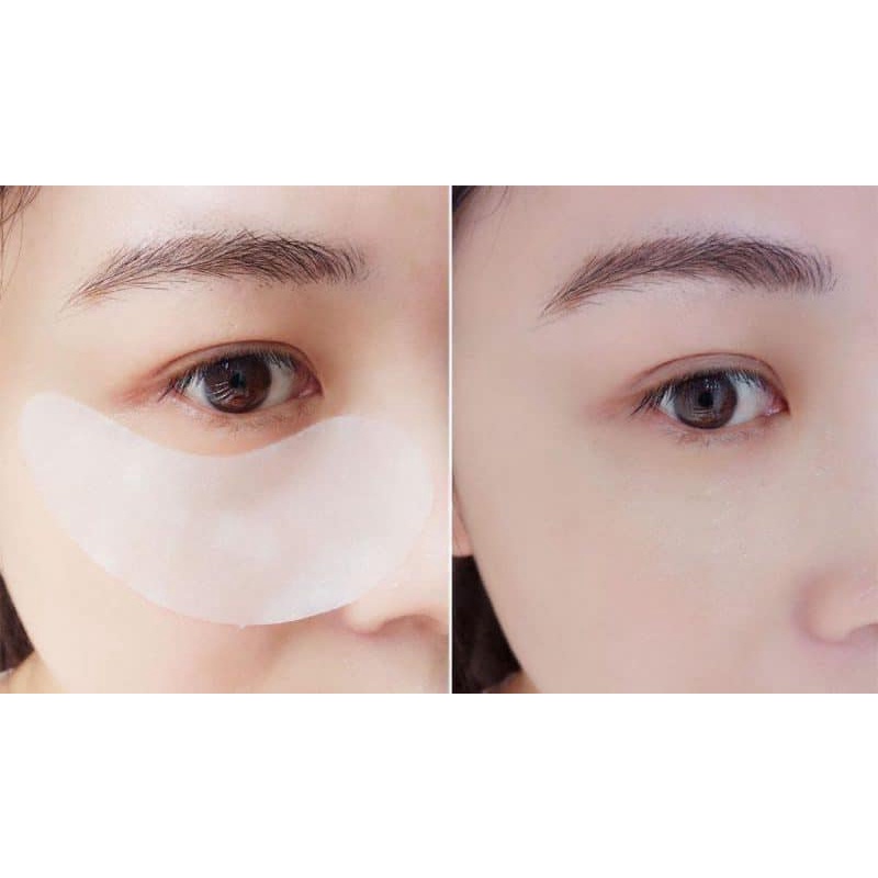 Mặt Nạ Mắt The Stem Cell Treatment Eye Sheet - MẶT NẠ TẾ BÀO GỐC NHẬT BẢN