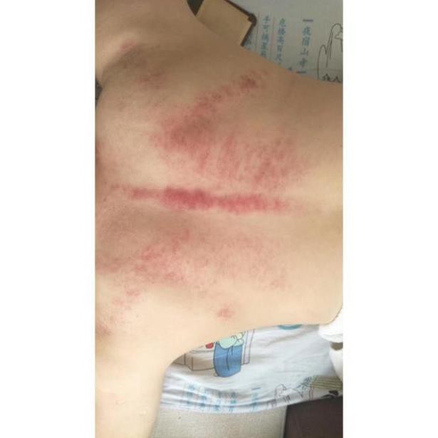 CHUYÊN SỈ Tinh dầu massa VAI CỔ CAO CẤP