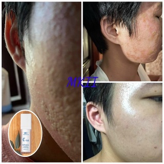 [mua 1 tặng 2] Tế bào gốc C-Cell MKII 30ml MKII